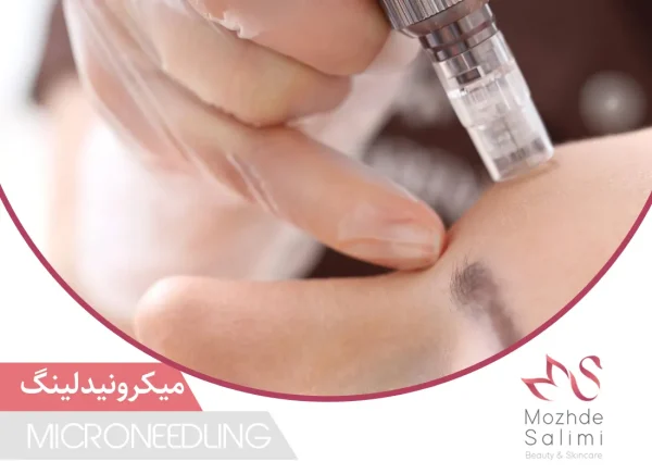 میکرونیدلینگ