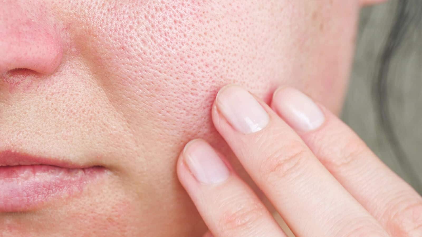 Dermatologists Reveal 10 Ways to Reduce Large Pores 1600x900 1